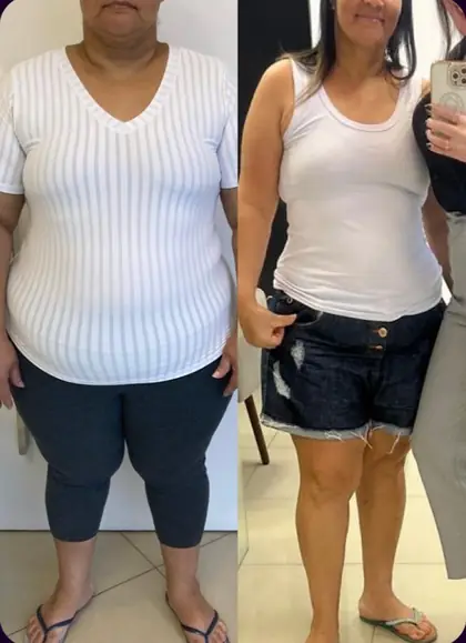 Comparação antes e depois de corpo inteiro de mulher