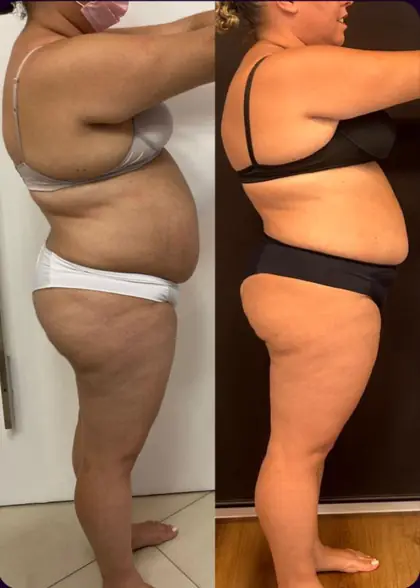 Comparação antes e depois de mulher em vista lateral de corpo inteiro
